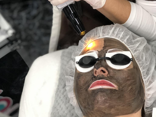 Peeling por láser